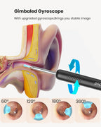 Ear Wax Removal:Ear Cleaner with HD Ear Camera FSA